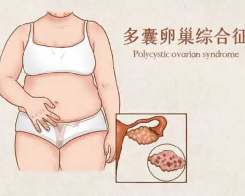 广州传承生殖中心的位置[大龄女怀孕咨询],试管婴儿Y染色体检查到底有多重要