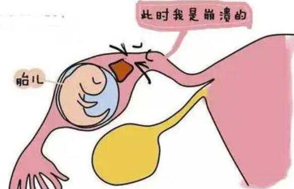「孕宝国际科普」大龄女性做试管婴儿注意事项